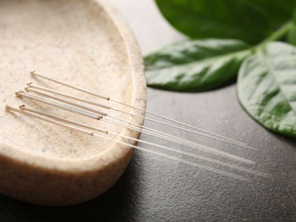 Prawda o akupunkturze: Czym jest, jak ją uzyskać i jakie są jej możliwe korzyści